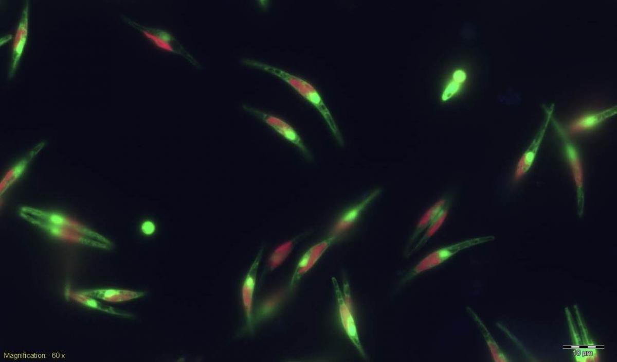 Diatom cells expressing ROS-sensitive proteins in the nucleus (green) and chlorophyll (red)